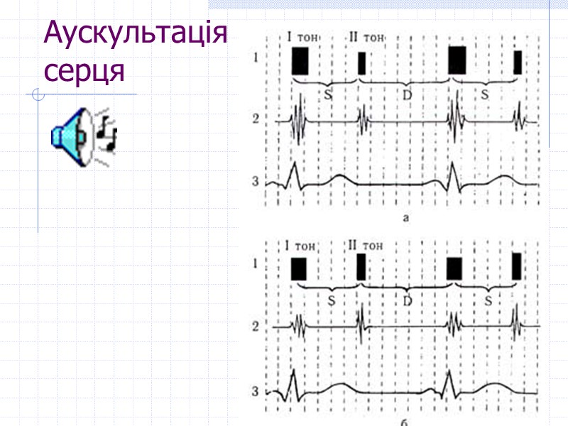 Аускультація  серця